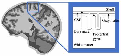 Multi-Scale Computational Models for Electrical Brain Stimulation